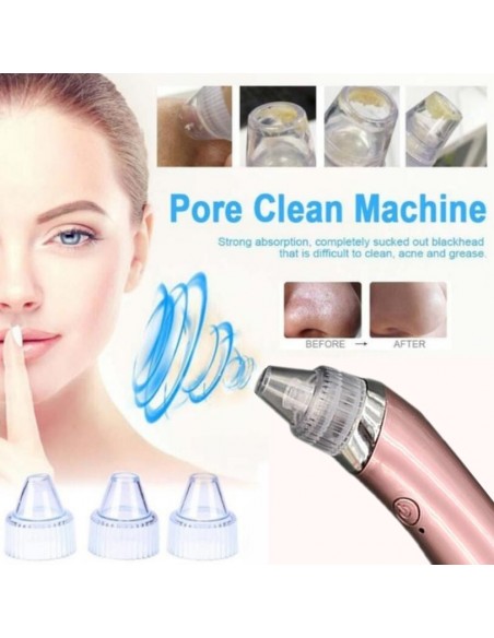 LIMPADOR FACIAL ELETRICO PONTOS NEGROS VÁCUUM | Virtualvantagem | VRT.002.00082