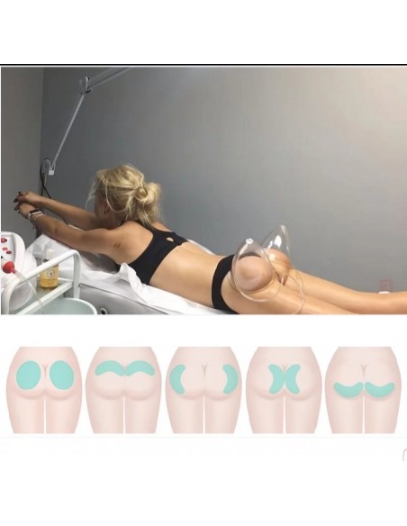 MAQUINA DE VACUUM TERAPIA PEITO ,GLUTEOS ,ETC | Virtualvantagem |