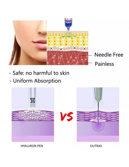 HYALURON PEN CANETA PRESSURIZADA INTRADERMO | Virtualvantagem | VRT.002.00036