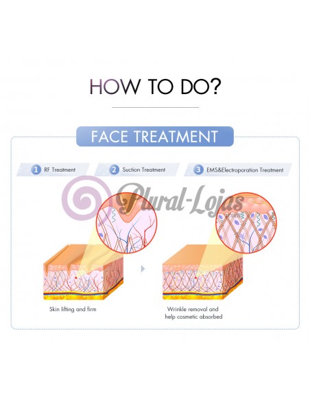 MAQUINA S SHAPE CAVITAÇÃO + RADIOFREQUENCIA | Virtualvantagem | VRT.001.00028