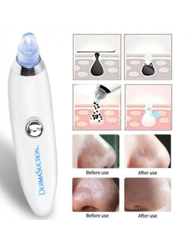 DERMASUCTION REMOVEDOR DE PONTOS NEGROS | Virtualvantagem | VRT.002.00083