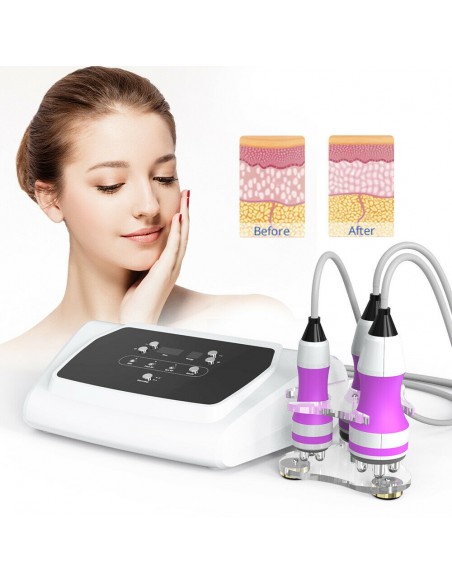 CAVITAÇÃO UNOISETION + RADIOFREQUENCIA + INFRAVERMELHOS | Virtualvantagem | VRT.001.00004