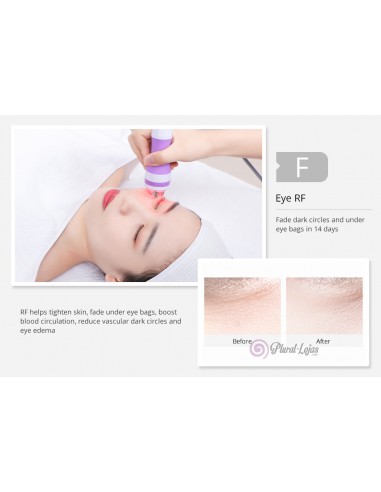 CAVITAÇÃO UNOISETION + RADIOFREQUENCIA + INFRAVERMELHOS | Virtualvantagem | VRT.001.00004