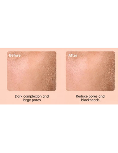 ESCOVA SÓNICA ELETRICA FACIAL | Virtualvantagem | VRT.002.00133