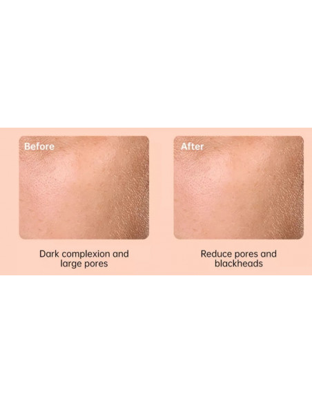 ESCOVA SÓNICA ELETRICA FACIAL | Virtualvantagem | VRT.002.00133