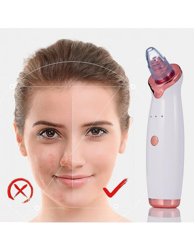 REMOVEDOR PONTOS NEGROS MICRODERMOABRASÃO | Virtualvantagem | VRT.002.00143