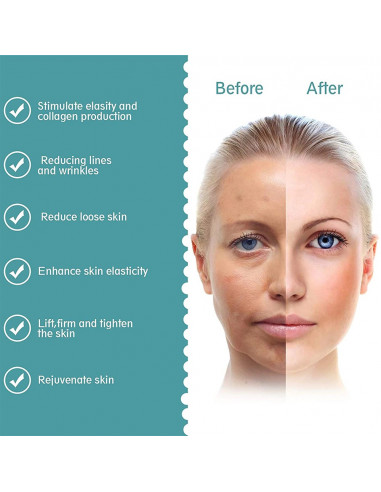 MINI HIFU SEGUNDA GERAÇÃO 3 EM 1 | MAQUINAS DE RADIOFREQUENCIA | Plural Lojas