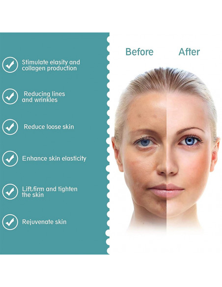 APARELHO MINI HIFU SEGUNDA GERAÇÃO | Virtualvantagem | VRT.002.00034