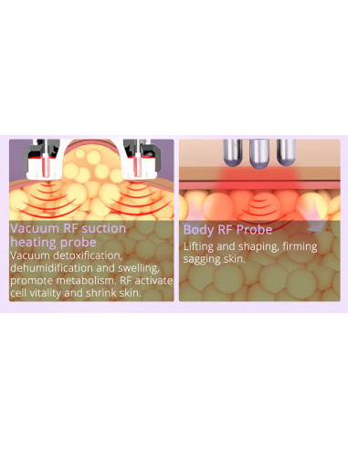 MAQUINA  CAVITAÇÃO LIPO LASER E RADIOFREQUENCIA