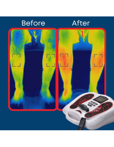 MASSAGEADOR DE PÉS INFRAVERMELHO REFLEXOTERAPIA