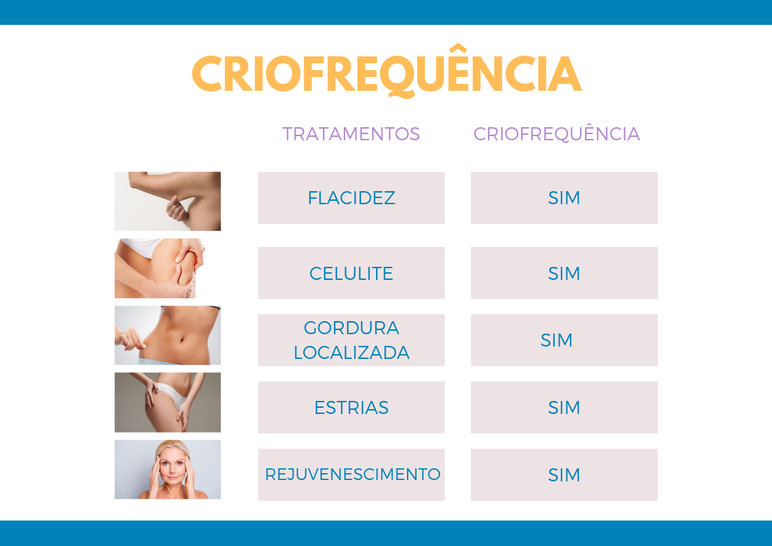 criofrequencia-tratamento.png